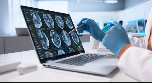 Best Neuro Clinic in Powai